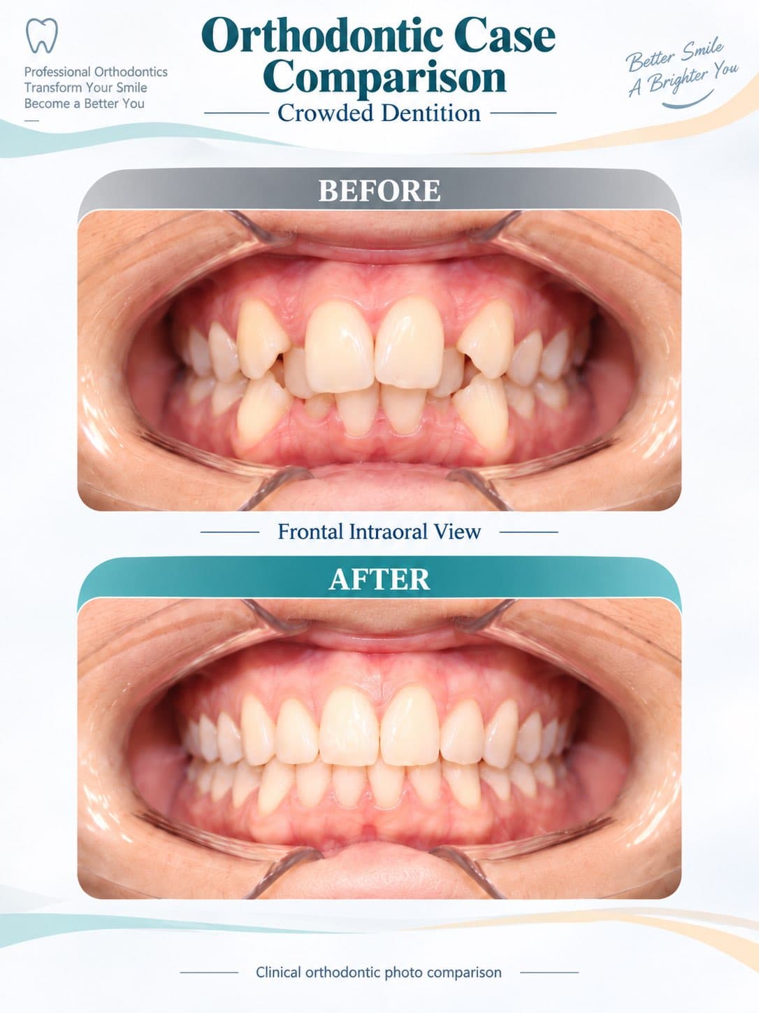 Orthodontics: before and after
